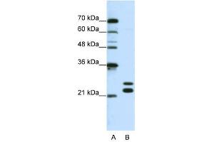CSDC2 antibody used at 0. (CSDC2 anticorps  (N-Term))