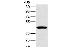 Western Blot analysis of A375 cell using MAGEA10 Polyclonal Antibody at dilution of 1:400 (MAGEA10 anticorps)