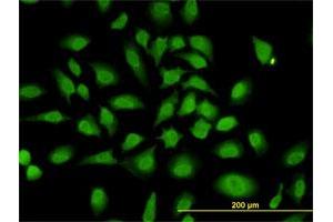 Immunofluorescence of monoclonal antibody to PCBP2 on HeLa cell.