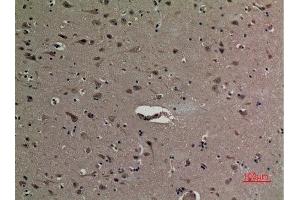 Immunohistochemistry (IHC) analysis of paraffin-embedded Human Brain, antibody was diluted at 1:100. (HMGB1 anticorps  (acLys12))