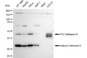 Western blotting analysis using Cathepsin D antibody (ABIN7797938).
