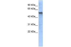 WB Suggested Anti-TPH2 Antibody Titration:  0. (Tryptophan Hydroxylase 2 anticorps  (Middle Region))