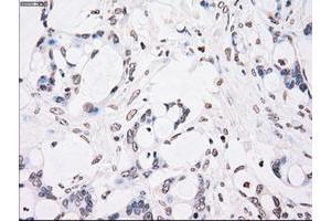 Image no. 2 for anti-Checkpoint Kinase 2 (CHEK2) antibody (ABIN1497499) (CHEK2 anticorps)