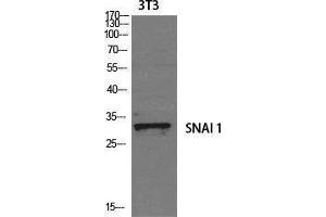Western Blotting (WB) image for anti-SNAIL (SNAI1) (Tyr1102) antibody (ABIN3177452) (SNAIL anticorps  (Tyr1102))