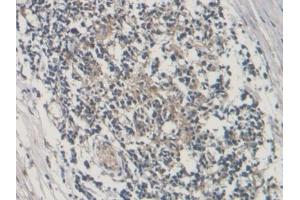 Detection of CTGF in Human Lymph node Tissue using Polyclonal Antibody to Connective Tissue Growth Factor (CTGF)