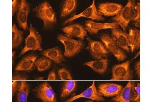 Immunofluorescence analysis of U-2 OS cells using RPS3 Polyclonal Antibody at dilution of 1:100. (RPS3 anticorps)