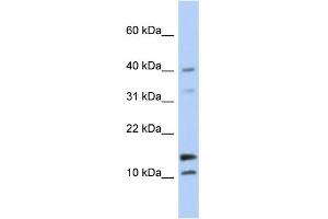 WB Suggested Anti-WFDC5 Antibody Titration: 0. (WFDC5 anticorps  (N-Term))