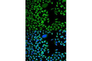 Immunofluorescence analysis of HeLa cells using TIA1 antibody. (TIA1 anticorps)