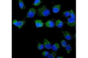 IF analysis of STXBP2 using anti-STXBP2 antibody (ABIN3043304).