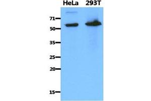 The cell lysates of HeLa (40ug) and 293T (40ug) were resolved by SDS-PAGE, transferred to PVDF membrane and probed with anti-human PDZK1 antibody (1:1000). (PDZK1 anticorps)