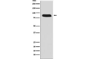 Western blot analysis of GCSF Receptor (CD114) expression in Caco-2 cell lysate.