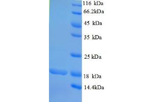 SDS-PAGE (SDS) image for Rhomboid, Veinlet-Like 2 (RHBDL2) (AA 12-132), (partial) protein (His tag) (ABIN5710258)