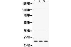Western Blotting (WB) image for anti-HRas proto-oncogene, GTPase (HRAS) (AA 101-137), (C-Term) antibody (ABIN3043845) (HRAS anticorps  (C-Term))