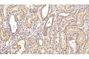 Detection of CEACAM1 in Human Kidney Tissue using Monoclonal Antibody to Carcinoembryonic Antigen Related Cell Adhesion Molecule 1 (CEACAM1)