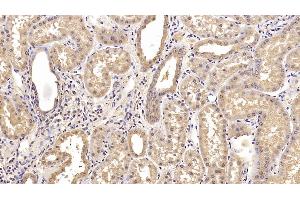 Detection of CEACAM1 in Human Kidney Tissue using Monoclonal Antibody to Carcinoembryonic Antigen Related Cell Adhesion Molecule 1 (CEACAM1) (CEACAM1 anticorps)