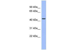 WB Suggested Anti-TRIOBP Antibody Titration:  0. (TRIOBP anticorps  (Middle Region))