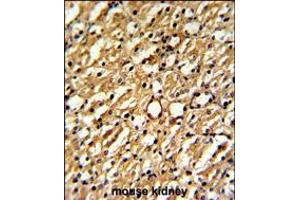Formalin-fixed and paraffin-embedded mouse kidney reacted with DDAH1 Antibody , which was peroxidase-conjugated to the secondary antibody, followed by DAB staining. (DDAH1 anticorps  (C-Term))