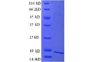 SDS-PAGE (SDS) image for Carcinoembryonic Antigen-Related Cell Adhesion Molecule 4 (CEACAM4) (AA 36-155), (partial) protein (His tag) (ABIN5709271)