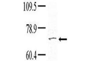 Western blot analysis of TNK1 antibody (1:100) in HeLa lysate; Courtesy of Dr. (TNK1 anticorps  (AA 256-286))