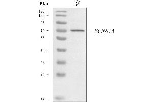 Western blot analysis of Epithelial Sodium Channel Alpha/SCNN1A using anti-Epithelial Sodium Channel Alpha/SCNN1A antibody (ABIN7602496).