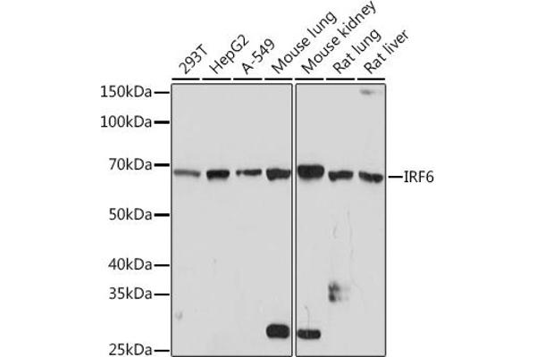 IRF6 anticorps