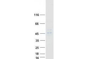 Validation with Western Blot