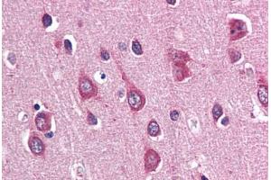 Human Brain, Cortex (formalin-fixed, paraffin-embedded) stained with PAK3 antibody ABIN337352 at 10 ug/ml followed by biotinylated goat anti-rabbit IgG secondary antibody ABIN481713, alkaline phosphatase-streptavidin and chromogen. (PAK3 anticorps  (N-Term))