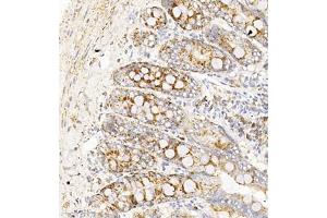Immunohistochemistry of paraffin embedded rat duodenum using TAF4 (ABIN7075827) at dilution of 1:450 (300x lens)