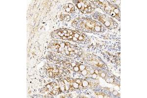 Immunohistochemistry of paraffin embedded rat duodenum using TAF4 (ABIN7075827) at dilution of 1:450 (300x lens) (TAF4 anticorps)