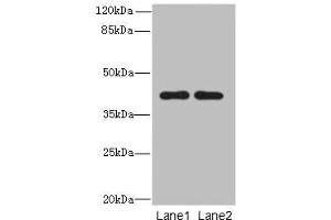 Western blot All lanes: CIPC antibody at 6 μg/mL Lane 1: A431 whole cell lysate Lane 2: NIH/3T3 whole cell lysate Secondary Goat polyclonal to rabbit IgG at 1/10000 dilution Predicted band size: 43 kDa Observed band size: 43 kDa (CIPC/KIAA1737 anticorps  (AA 1-399))