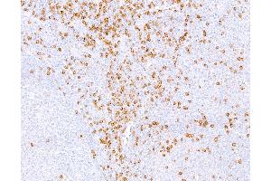 Immunohistochemistry (IHC) image for anti-CD8a Molecule (CD8A) (C-Term), (Cytoplasmic Domain) antibody (ABIN7449043) (CD8 alpha anticorps  (C-Term, Cytoplasmic Domain))