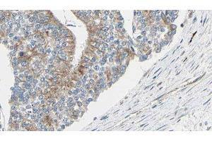 ABIN6276977 at 1/100 staining Human prostate tissue by IHC-P. (TCP1 alpha/CCTA anticorps  (C-Term))