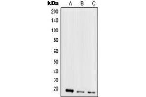Western blot analysis of Mammaglobin A expression in MCF7 (A), MDAMB435 (B), HeLa (C), HepG2 (D) whole cell lysates. (Mammaglobin A anticorps  (Center))