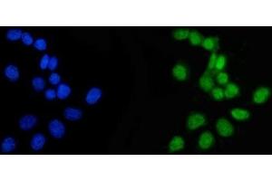 IF analysis of APRT using anti-APRT antibody (ABIN4886471). (APRT anticorps  (N-Term))