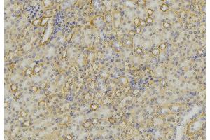 ABIN6279615 at 1/100 staining Mouse kidney tissue by IHC-P.
