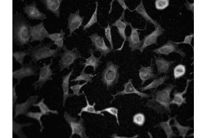 Immunofluorescence staining of HeLa cells. (Phospholipase C gamma 1 anticorps  (N-Term))
