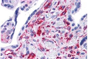 Human Placenta: Formalin-Fixed, Paraffin-Embedded (FFPE)