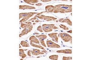(ABIN6242395 and ABIN6577138) staining MKRN2 in human heart tissue sections by Immunohistochemistry (IHC-P - paraformaldehyde-fixed, paraffin-embedded sections). (MKRN2 anticorps)