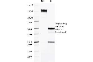 SDS-PAGE Analysis Purified CD50 Mouse Monoclonal Antibody (CG106). (ICAM-3/CD50 anticorps)