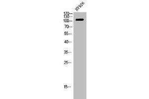 Western Blot analysis of HY926 cells using EphB4 Polyclonal Antibody (EPH Receptor B4 anticorps  (Internal Region))