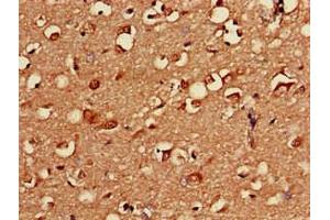 Immunohistochemistry of paraffin-embedded human brain tissue using ABIN7146602 at dilution of 1:100