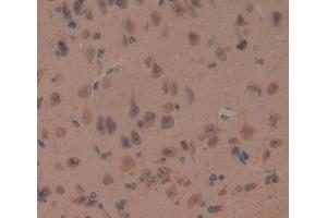 Used in DAB staining on fromalin fixed paraffin- embedded brain tissue