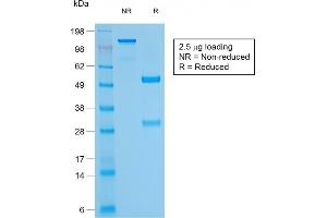 SDS-PAGE Analysis Purified CD79a Mouse Recombinant Monoclonal Antibody (rIGA/764). (Recombinant CD79a anticorps)