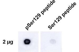 Dot Blot analysis using Rabbit Anti-Alpha Synuclein pSer129 Monoclonal Antibody, Clone J18 (ABIN6932881).