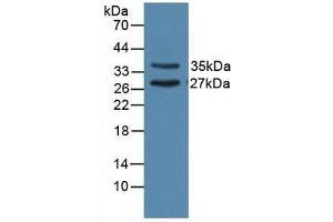 Figure. (UNG anticorps  (AA 1-313))