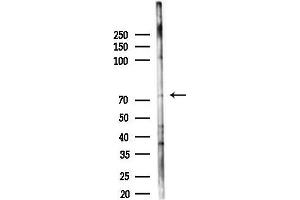 Western blot analysis of lysates from 293 cells(heat-shock 45 min treatment), using FNBP1 Antibody at 1/1000 dilution.