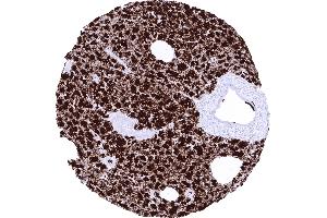 Pancreas (GP2 anticorps  (AA 35-179))