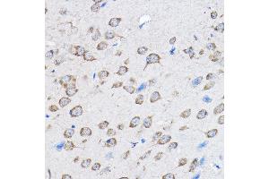 Immunohistochemistry of paraffin-embedded mouse brain using PTPN23 Rabbit pAb (ABIN1682396, ABIN3019081, ABIN3019082 and ABIN6220704) at dilution of 1:100 (40x lens). (PTPN23 anticorps  (AA 1230-1450))