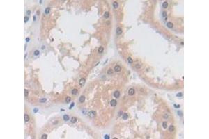 IHC-P analysis of Human Tissue, with DAB staining. (Vitamin D-Binding Protein anticorps  (AA 18-211))