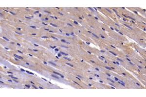 Detection of CASP9 in Rat Cardiac Muscle Tissue using Polyclonal Antibody to Caspase 9 (CASP9)